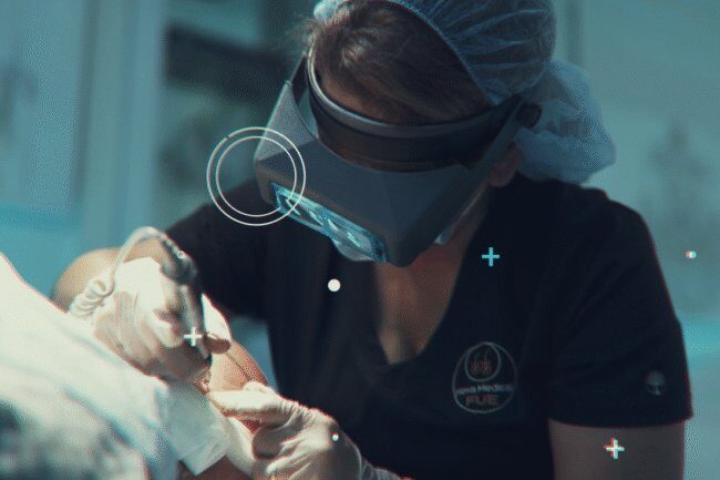 FUE hair transplant procedure