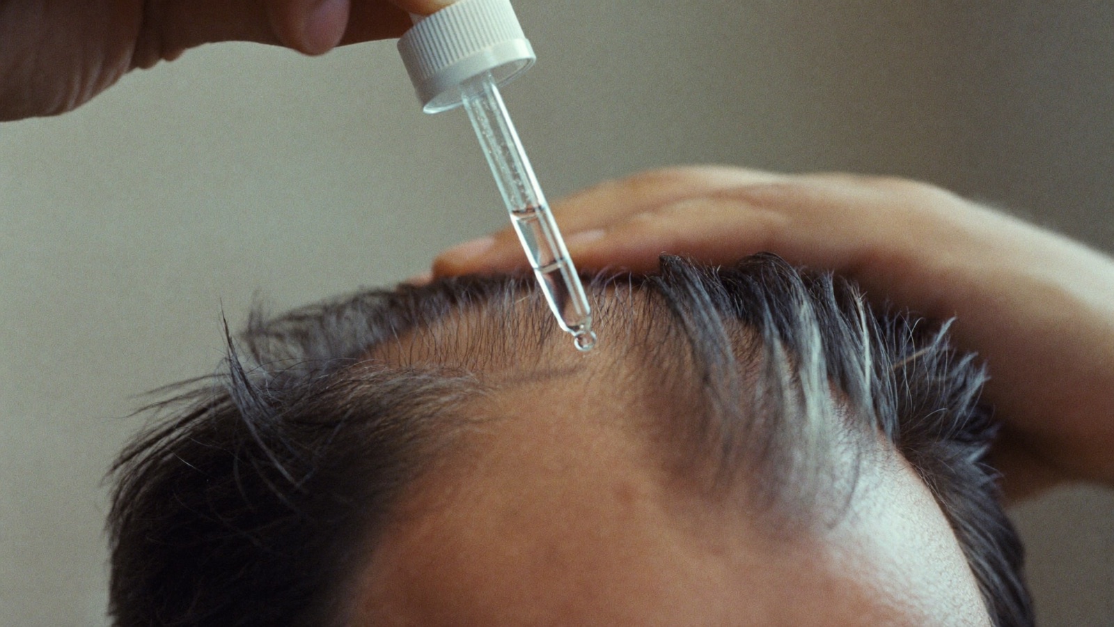 Close view of a dropper applying a liquid hair loss treatment to a man's hairline