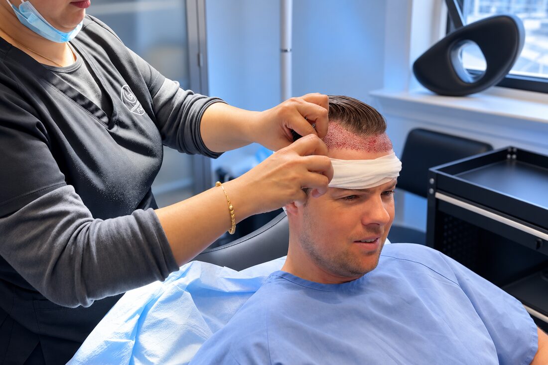 FUE hair transplant at Nova Medical Toronto